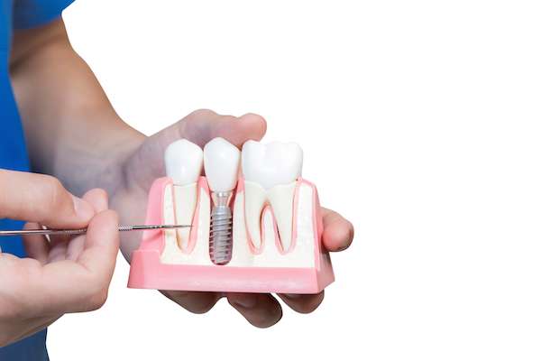 Can You Get Dental Implants if You Have Gum Disease from Total Care Implant Dentistry in Irvine, CA