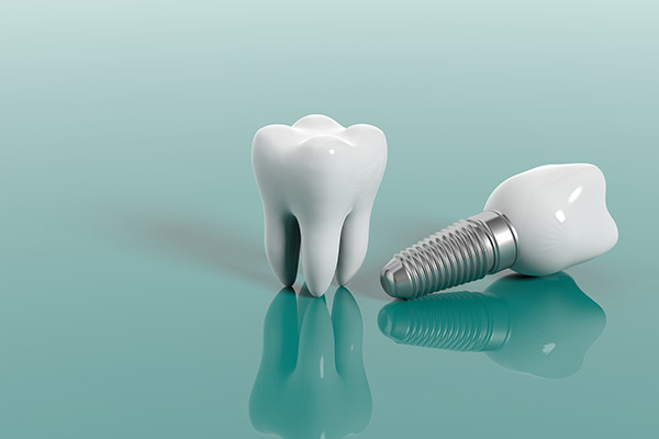 Cosmetic Dental Services Options With Implants from Total Care Implant Dentistry in Irvine, CA
