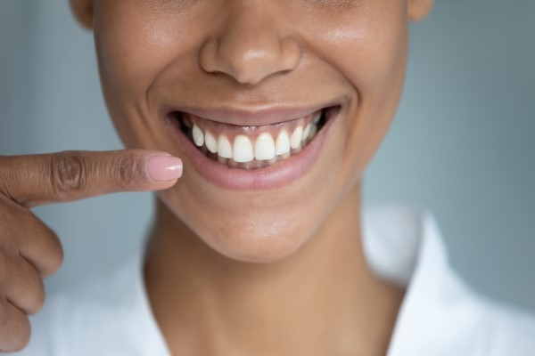 Facts About Dental Veneers
