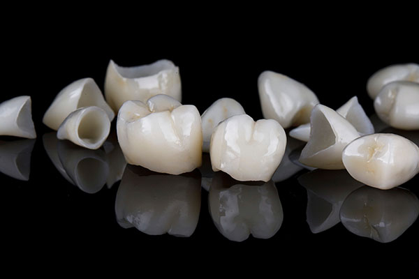 What Are The Differences Between A Dental Crown And A Dental Veneer?