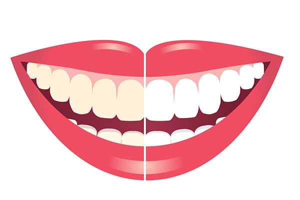 Daily General Dentistry Tips To Prevent Stained Teeth