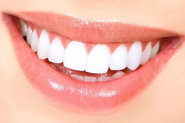 How Long Does Teeth Whitening Take from Sedation and Implant Dentistry Irvine in Irvine, CA