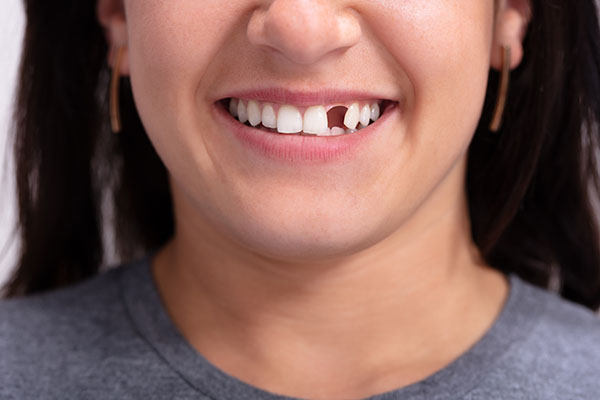 Options for Replacing Missing Teeth With Cosmetic Dental Services from Total Care Implant Dentistry in Irvine, CA